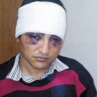 Alexis Retamal Jara, luego de la paliza que recibió en la Unidad de Detención 11 de Neuquén (arriba) y Silvia Cestona, de 78 años, asaltada y golpeada en su casa (abajo). Adentro y afuera, una frontera imaginaria. La brutalidad intramuros se propaga a